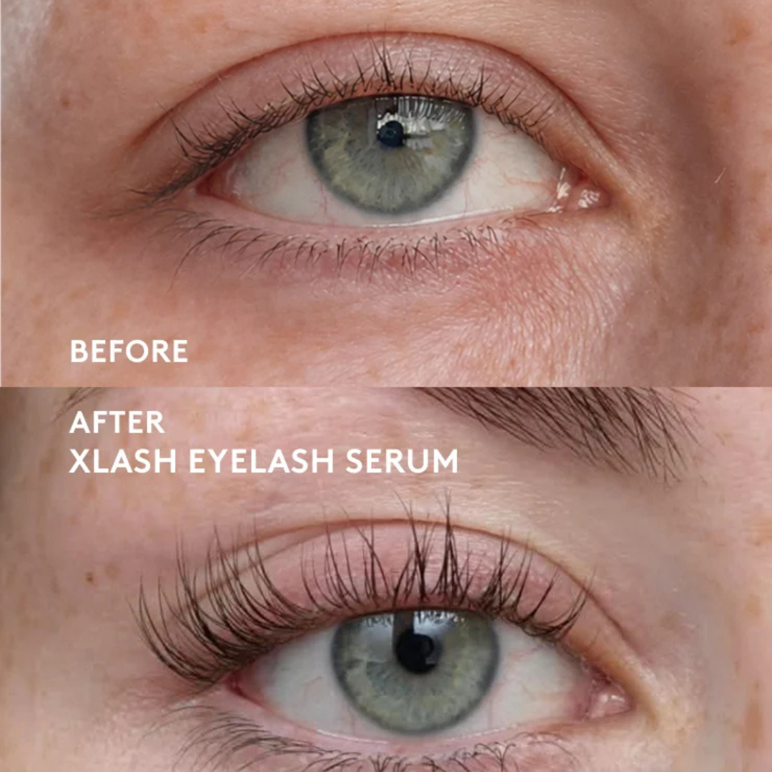 XLASH Eyelash Serum - skropstu serums, 3ml