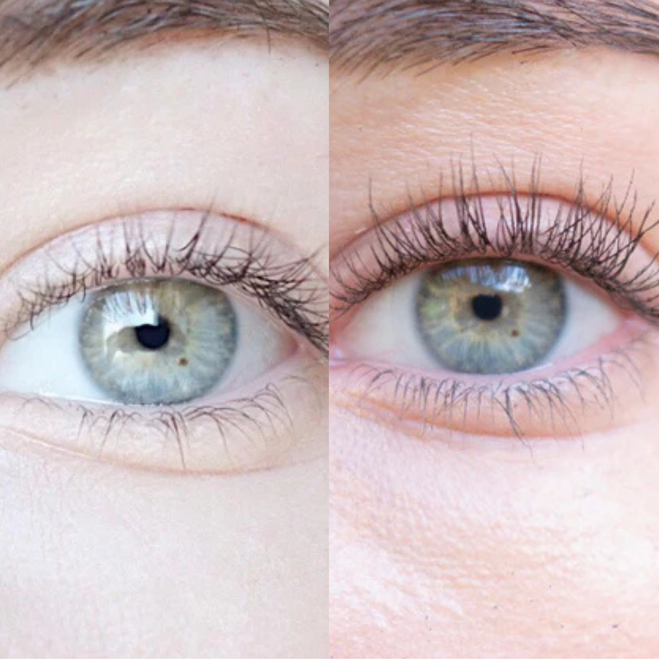 XLASH Wimpernserum - Wimpernserum, 5ml