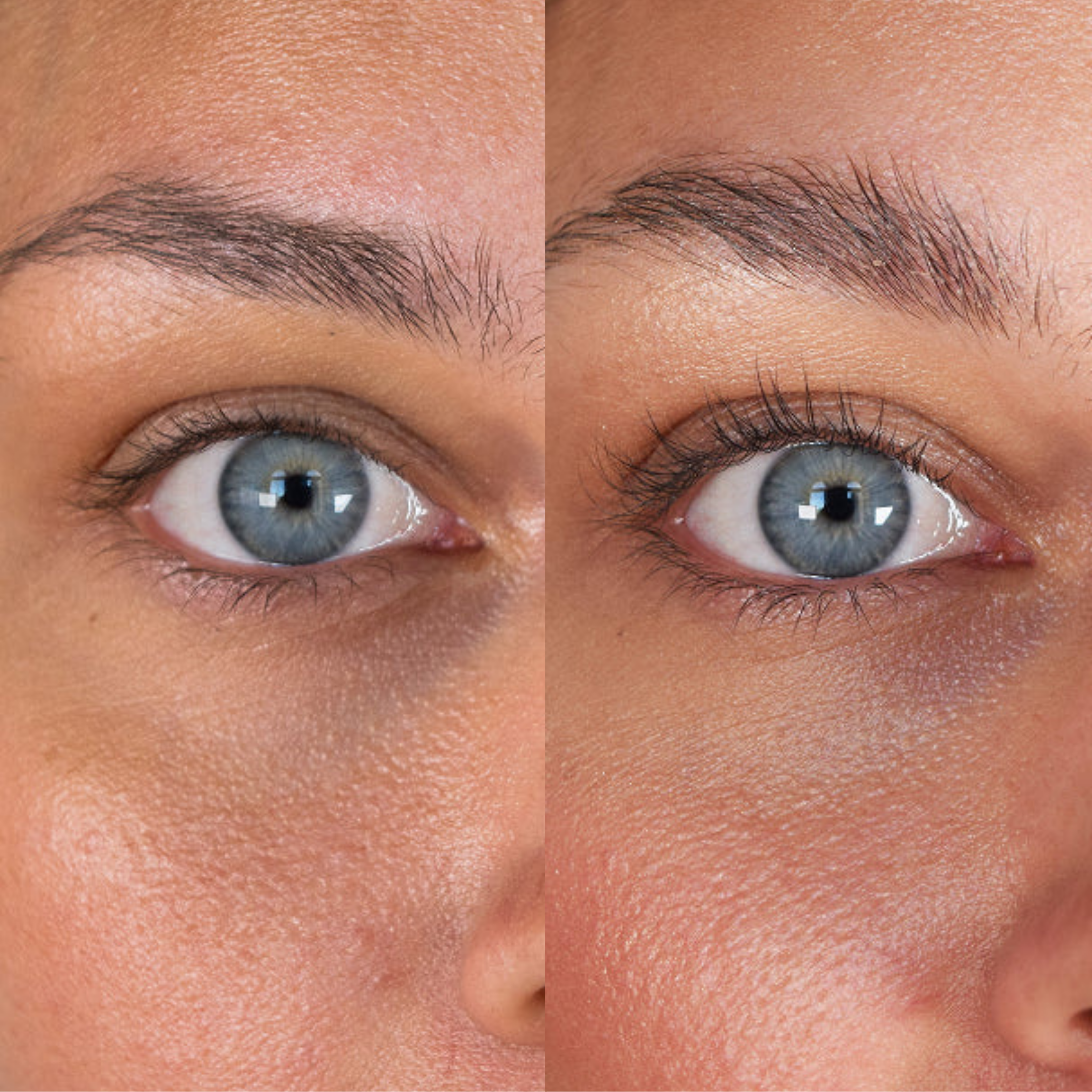 XLASH Wimpernserum - Wimpernserum, 5ml