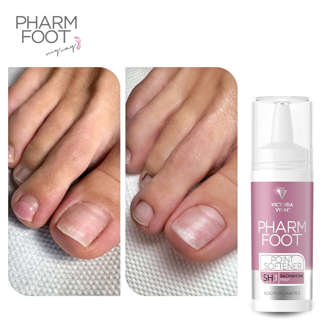 PHARM FOOT Flüssigkeit für eingewachsene Nägel, POINT SOFTENER 15ml