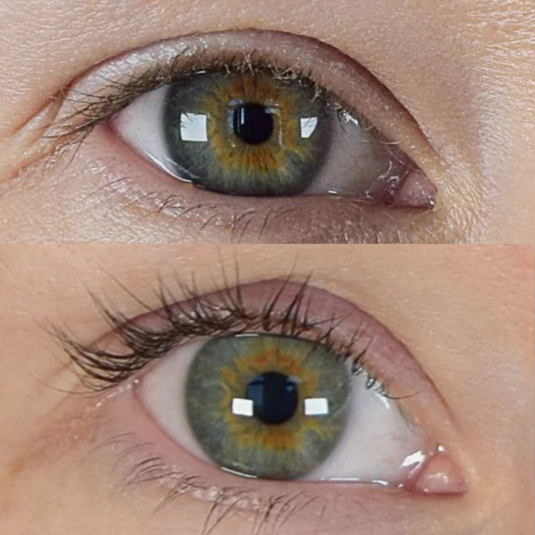 XLASH Sensitive Wimpernserum - Wimpernserum, 3ml